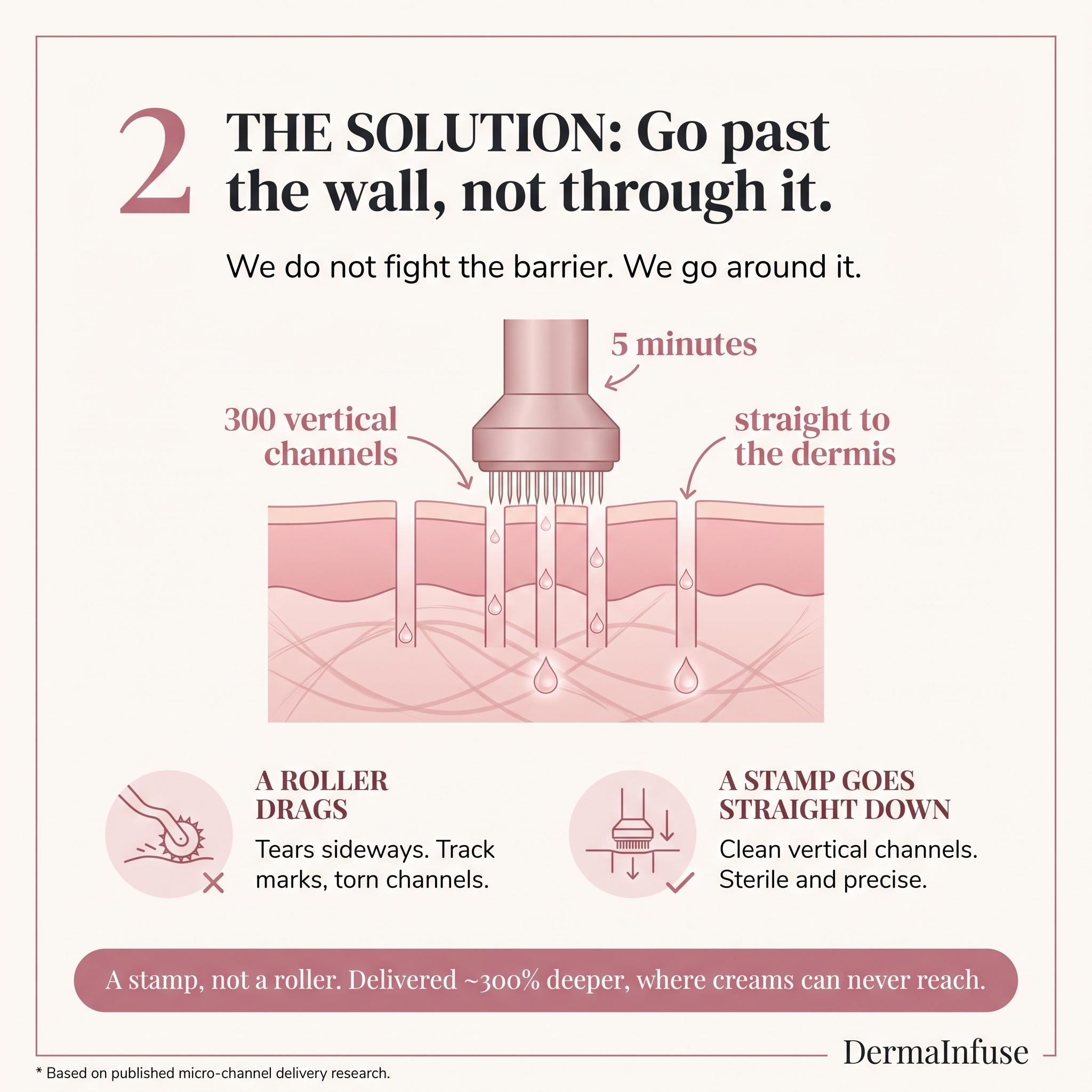 Age Backwards With DermaInfuse Micro-Infusion