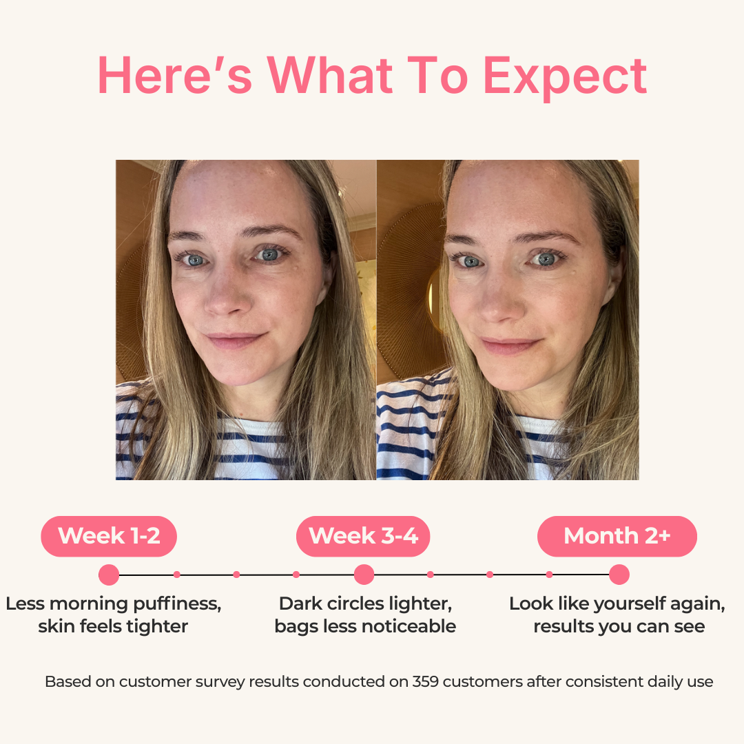 LumiGlow™ Red Light Under-Eye Therapy